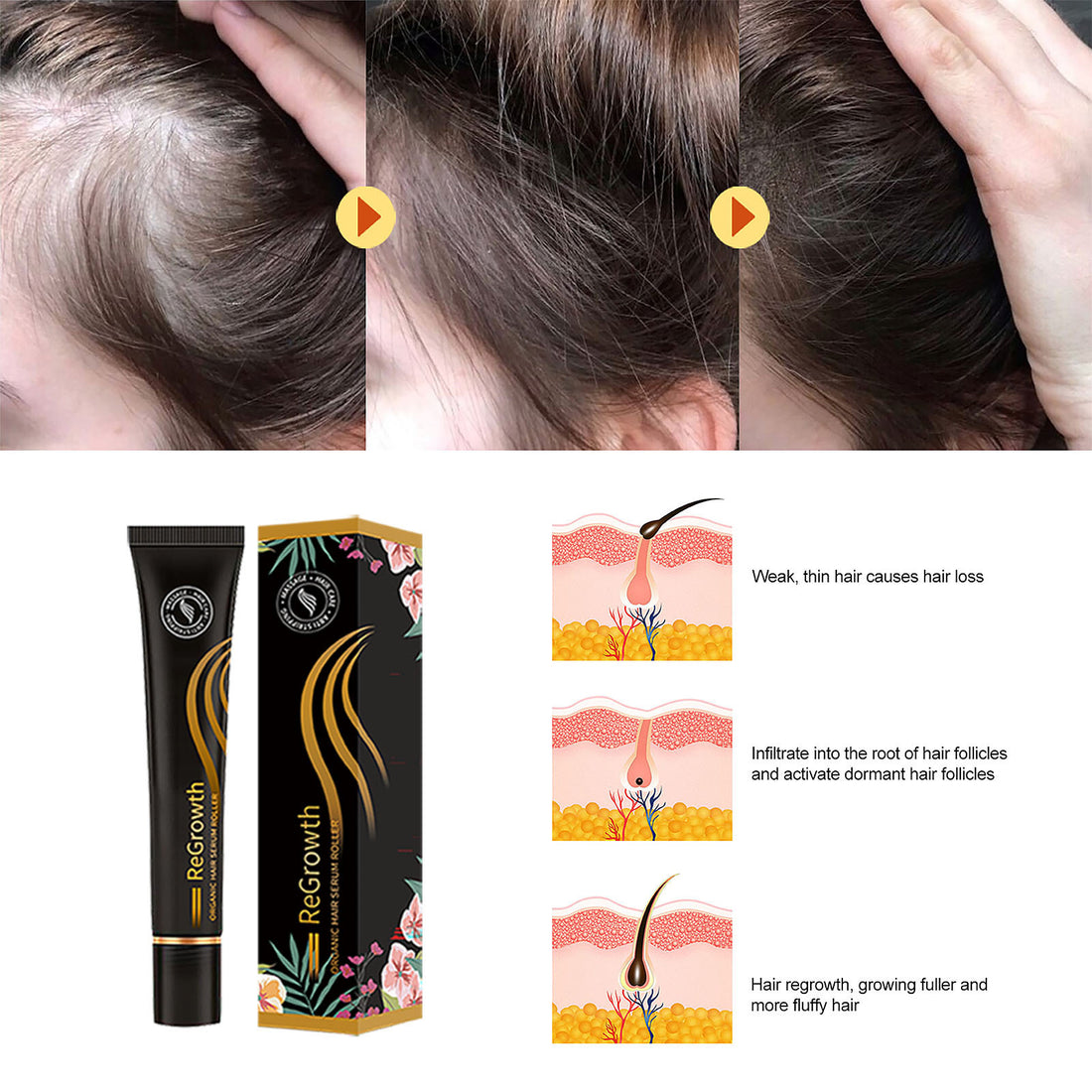 Hair Regrowth Treatment Set