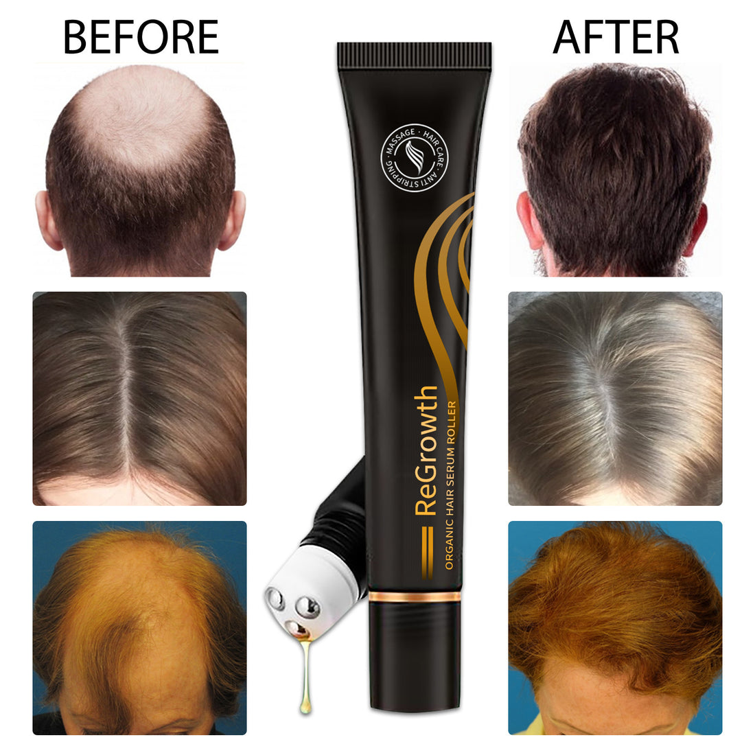 Hair Regrowth Treatment Set