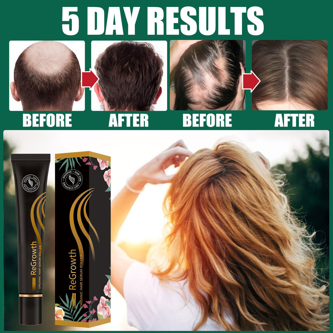 Hair Regrowth Treatment Set